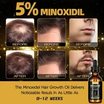 Conjunto Sérum de Crescimento Capilar Sefralls Minoxidil Biotina 5% - 6 Peças